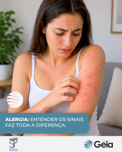 Géia: Alergia - entender os sinais faz toda a diferença